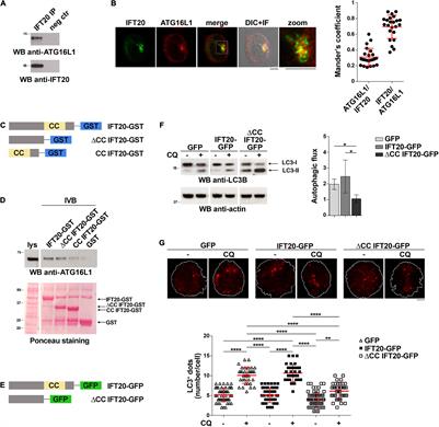 The Intraflagellar Transport Protein IFT20 Recruits ATG16L1 to Early Endosomes to Promote Autophagosome Formation in T Cells